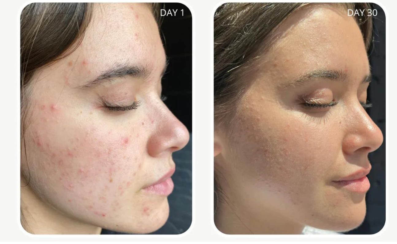 Retinol Anti-Aging Cream 20g
